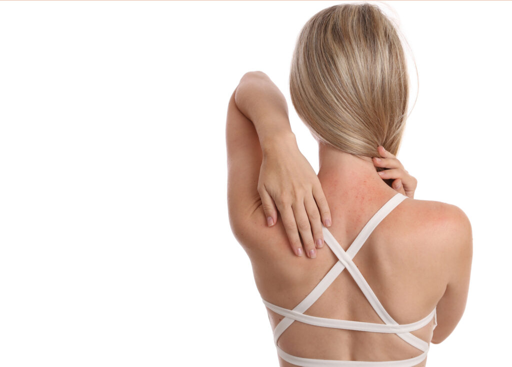 massages and sensitive skin PMA