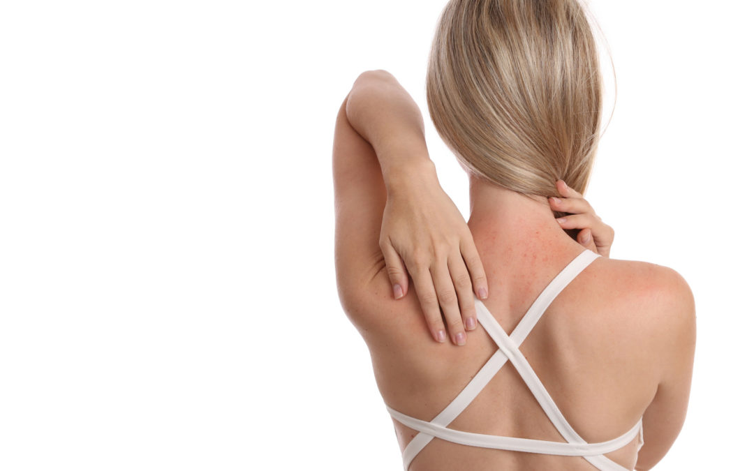 massages and sensitive skin PMA